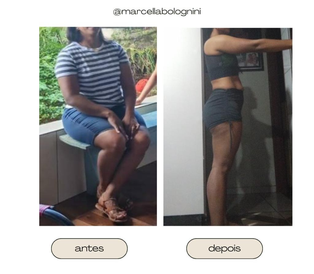 Antes e depois de aluna com corpo mais definido após o protocolo